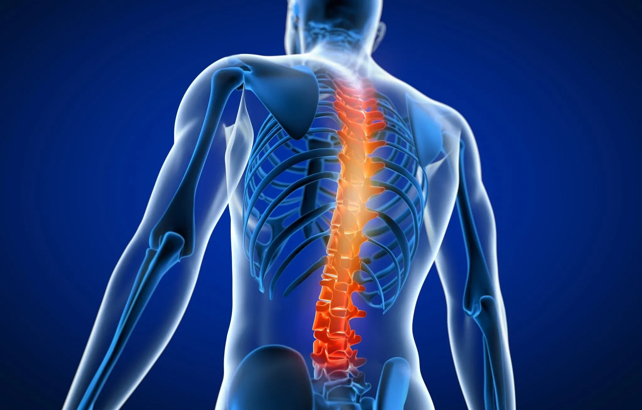 Spinal Stenosis treatment in Dwarka sector 12