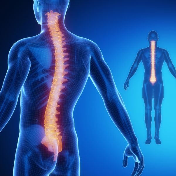 scoliosis surgery in Dwarka