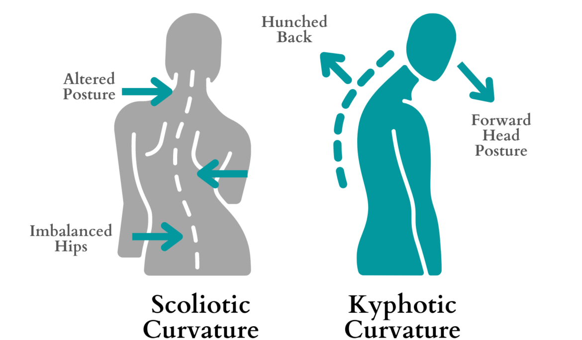 difference between scoliosis and kyphosis
