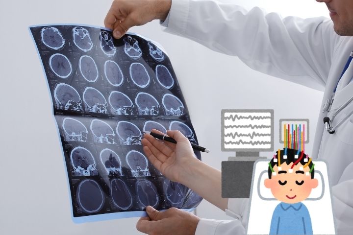 status epilepticus surgery in dwarka delhi