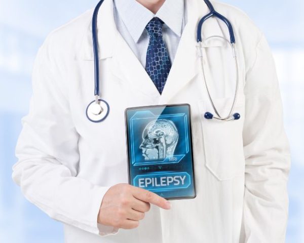 Epilepsy treatment in dwarka